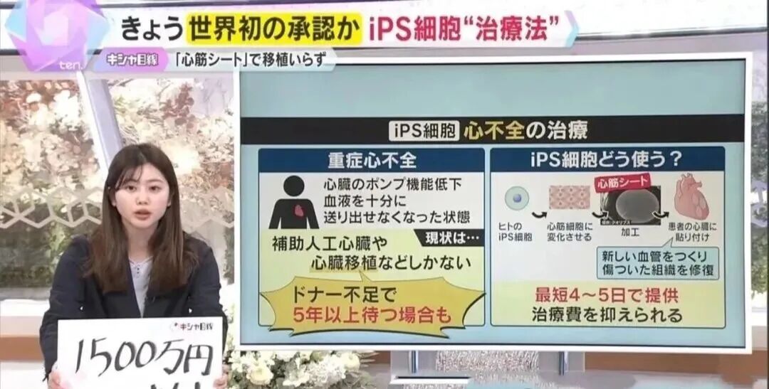 手指操救不了大脑：2026年，帕金森治疗迎来真正拐点